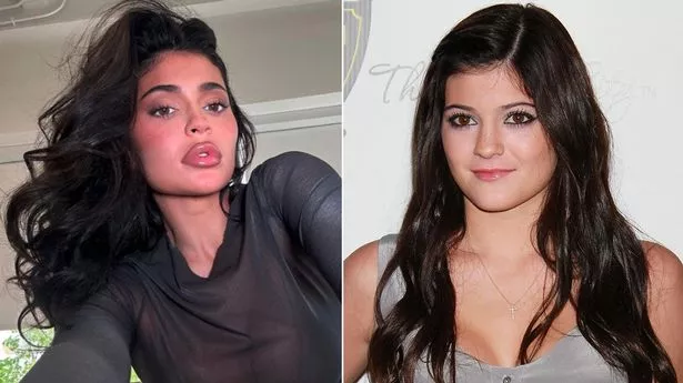 Kylie Jenner Addresses Criticisms About Plastic Surgery
