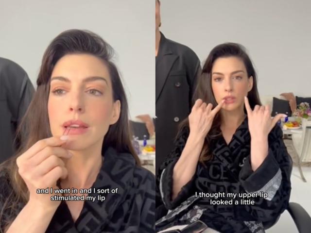 Anne Hathaway’s Hair Pin Hack for Fuller Lips Goes Viral