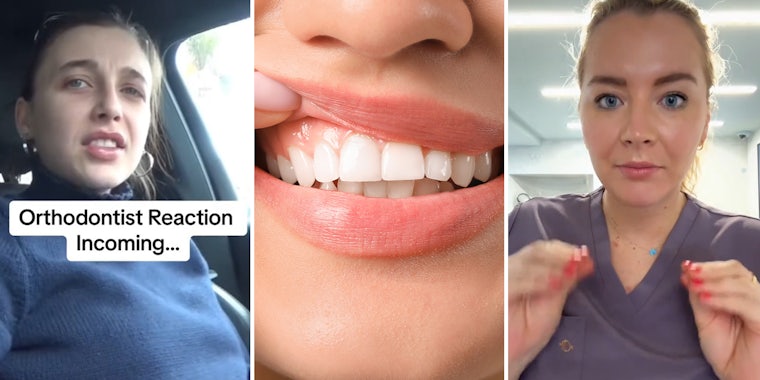 Expert Warns About Zyn Following Emma Chamberlain’s Dental Issues