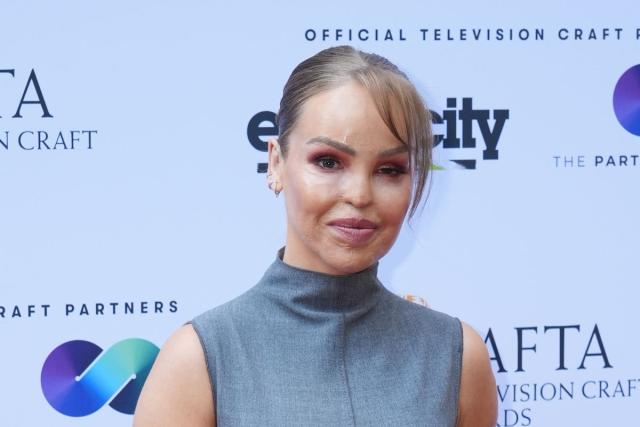 Katie Piper Exits ITV Show at the Last Minute